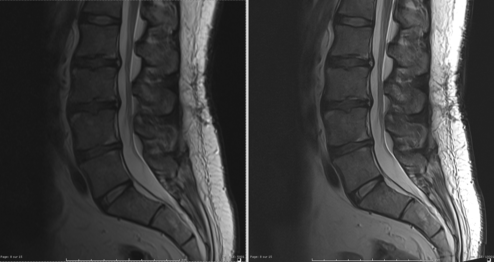 Clinique CHC MontLégia. Meilleure résolution d’images pour les IRM, grâce à l’IA